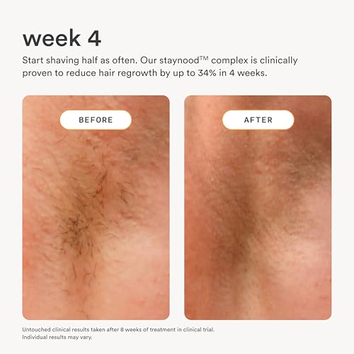 Nood NEW Serum — Slows Hair Regrowth, Shave Less — After Shave Oil Treats & Prevents Ingrown Hairs, Razor Bumps, Hair Cysts — Visible Results After First Use & Works Wherever Hair Grows