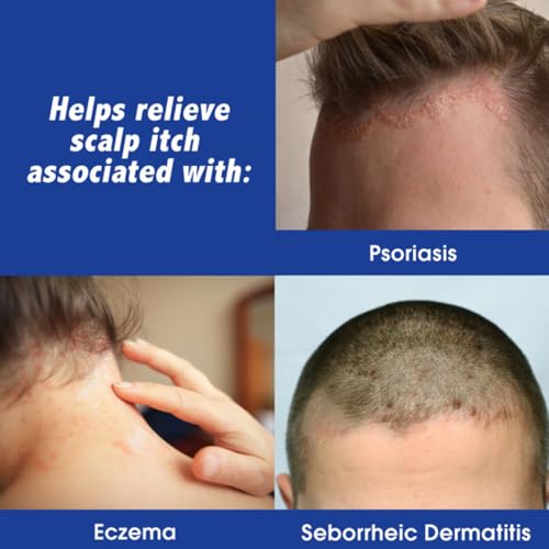 Scalpicin Scalp Itch Relief, 1.5 fl Oz. Maximum Strength (Pack of 6)