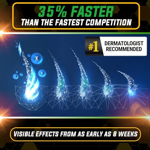 Elevate Hair Regrowth Treatment 5% Minoxidil Spray - Extra Strength Formula Professional Treatment for Hair Loss and Thinning for Regrowth - Stimulate Follicles for Men and Women 1 Month Supply